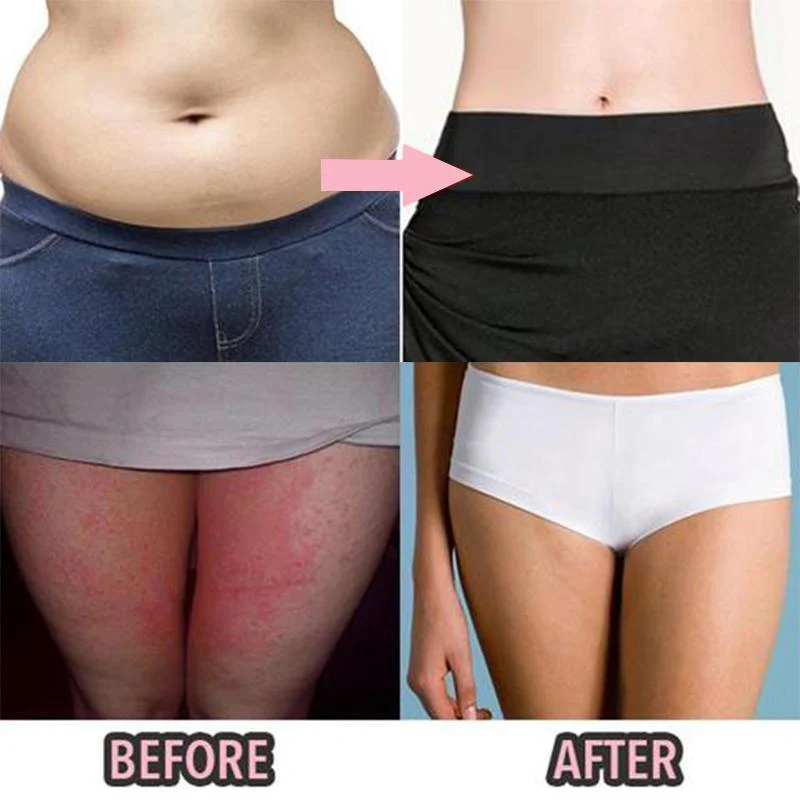 Anti-Chafing Active Skirt - Image 12