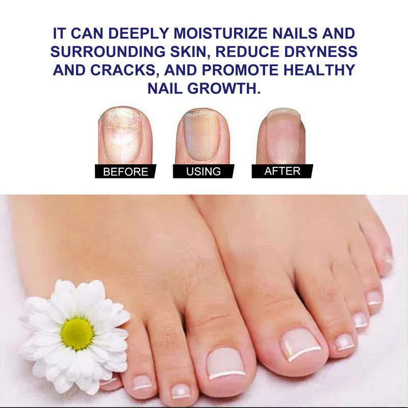 Nail Care Solution - Image 4