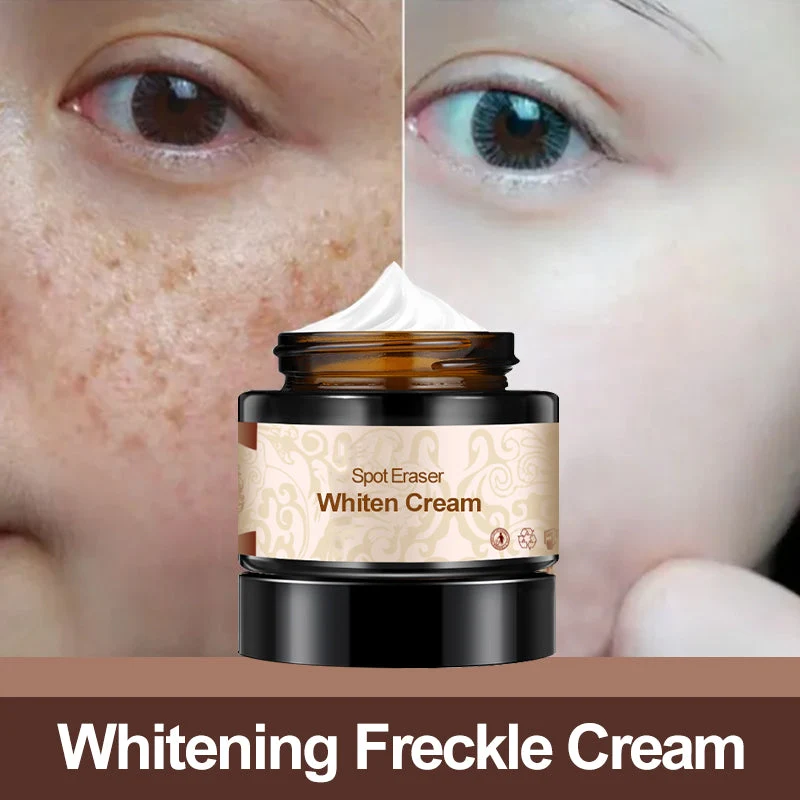 Plant lightening melanin freckle cream - Image 7