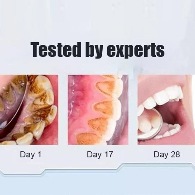 Super Probiotic-6 Toothpaste - Image 4