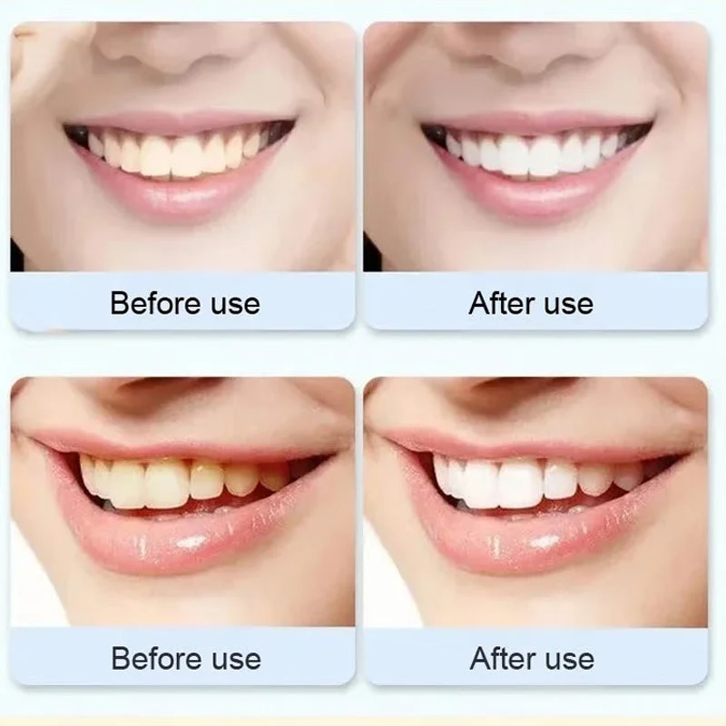 Super Probiotic-6 Toothpaste - Image 7